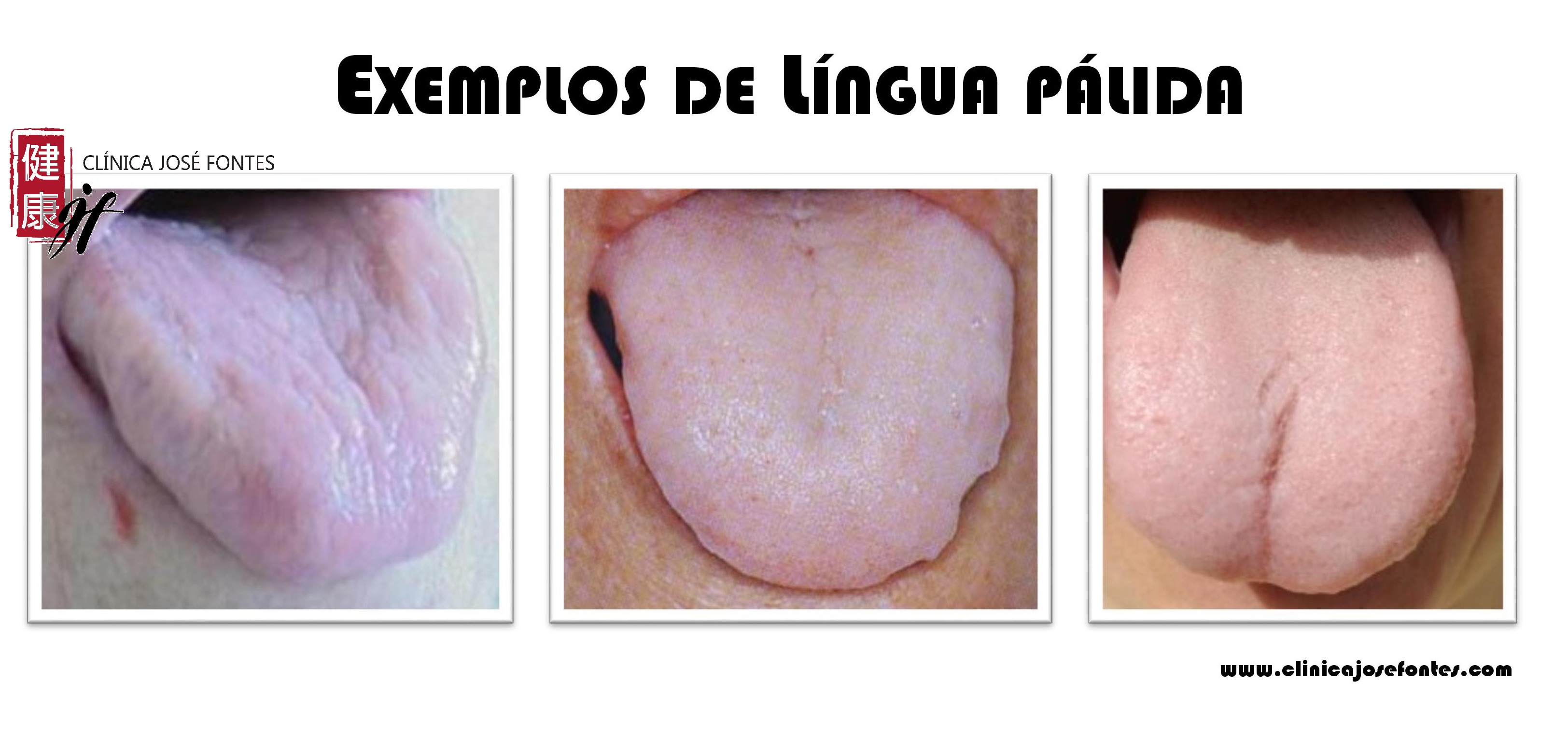 língua pálida