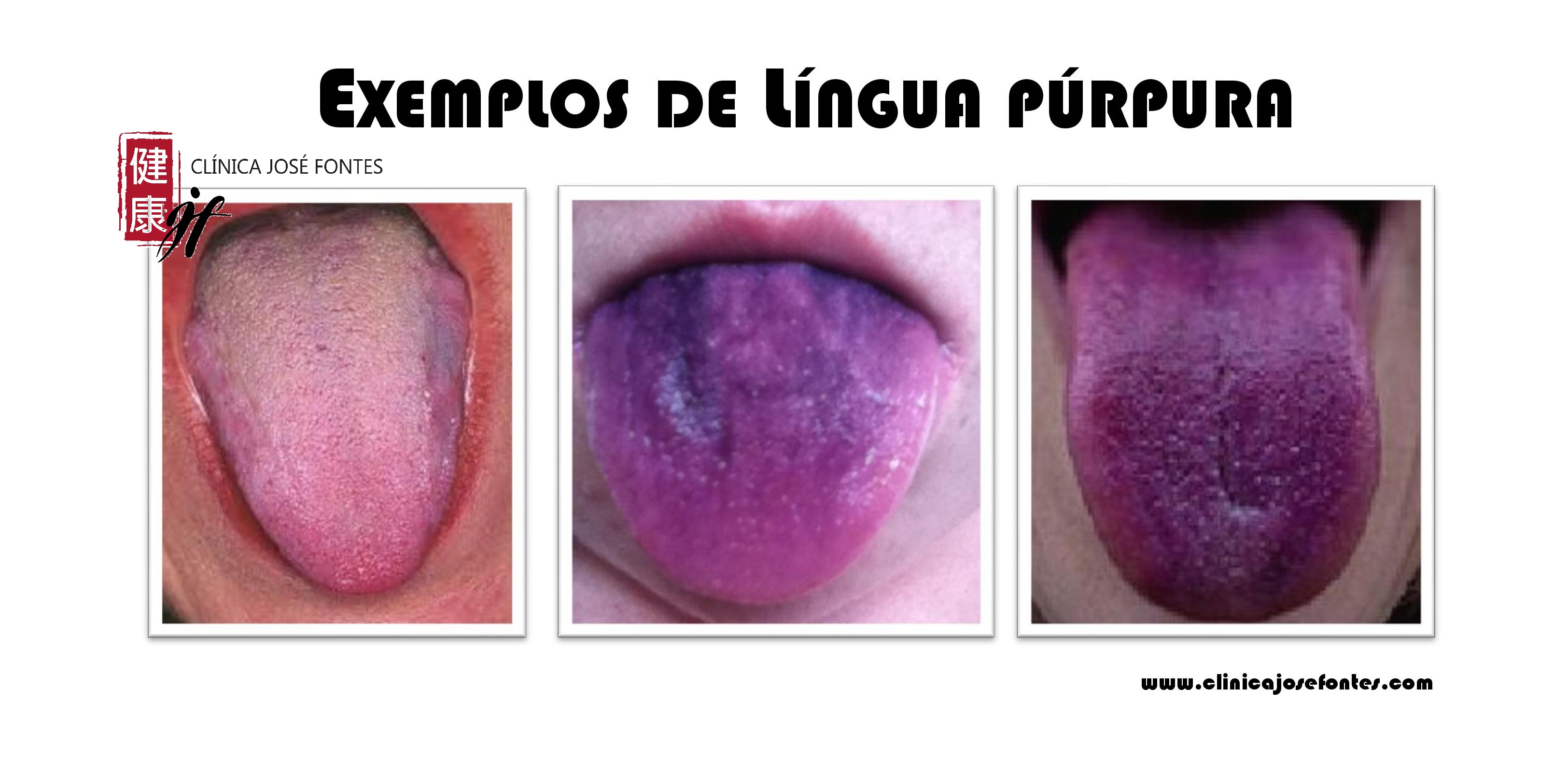 língua púrpura roxa