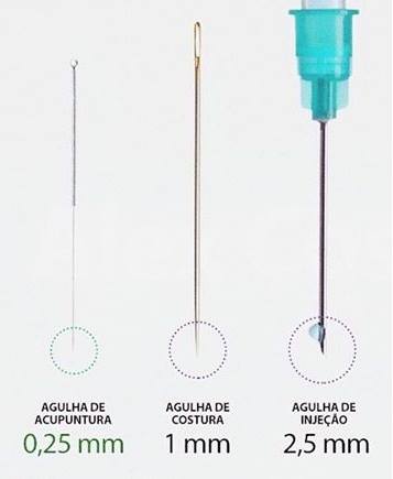 agulhas acupuntura finas