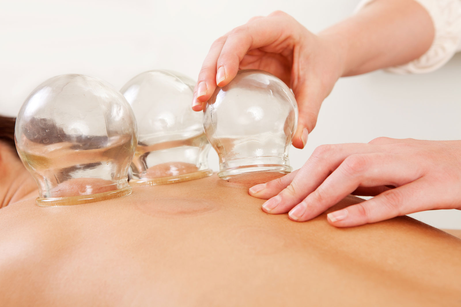 Ventosas (Cupping)