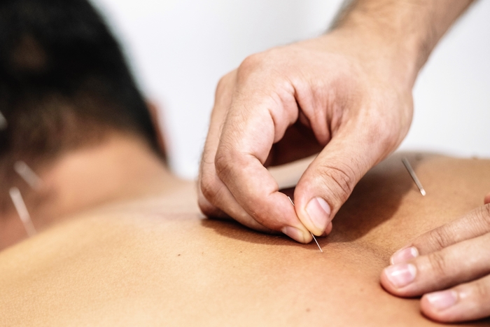 acupuntura medicina chinesa porto